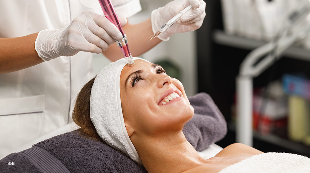 Exploring the Benefits of Microneedling - Featured Image